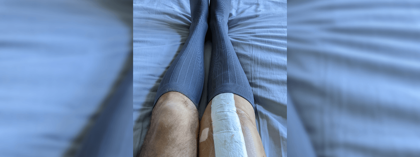 From Total Knee Replacement Surgery, Back to the Pickleball Court - OS1st