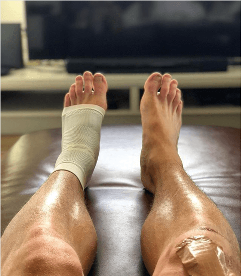 DS6 | Night Time Plantar Fasciitis Treatment - OS1st