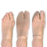 comparison of foot with bunion before and during HV3 bunion bracing sleeve use | OS1st