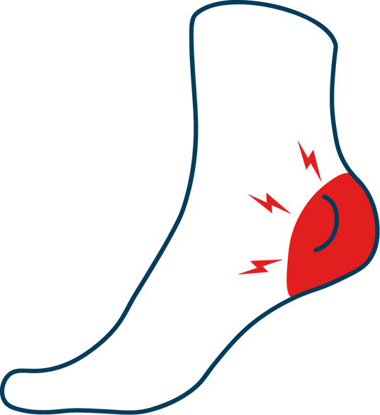 Outline of a leg with a red area indicating pain or discomfort on a white background